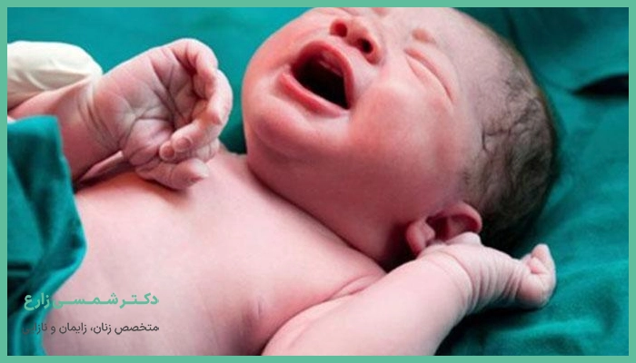 دلایل انجام زایمان سزارین
