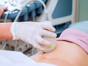 سونوگرافی داپلر در سنندج
