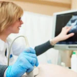 آزمایش آمنیوسنتز از مراحل تا مراقبت‌ها
