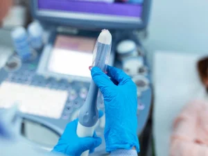 سونوگرافی واژینال در سنندج