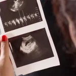 تعیین وزن جنین با سونوگرافی