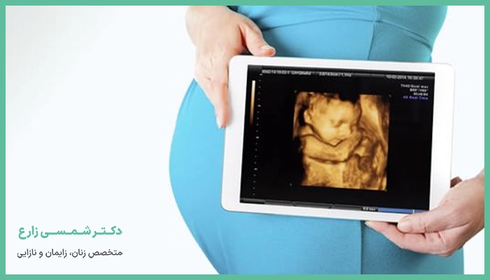 تعیین وزن جنین با سونوگرافی چگونه انجام می‌شود؟